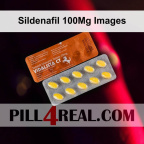 Sildenafil 100Mg Images 193