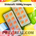 Sildenafil 100Mg Images 590