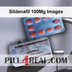 Sildenafil 100Mg Images 617