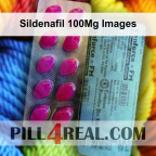 Sildenafil 100Mg Images 696