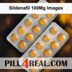 Sildenafil 100Mg Images 803