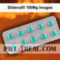 Sildenafil 100Mg Images 940