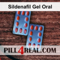 Sildenafil Gel Oral 585