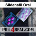 Sildenafil Oral 919