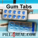 Gum Tabs 391