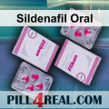 Sildenafil Oral 171
